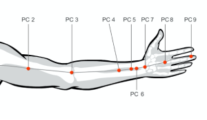 Stop headache pain on your temples by massaging acupressure points pericardium points 6 and 8